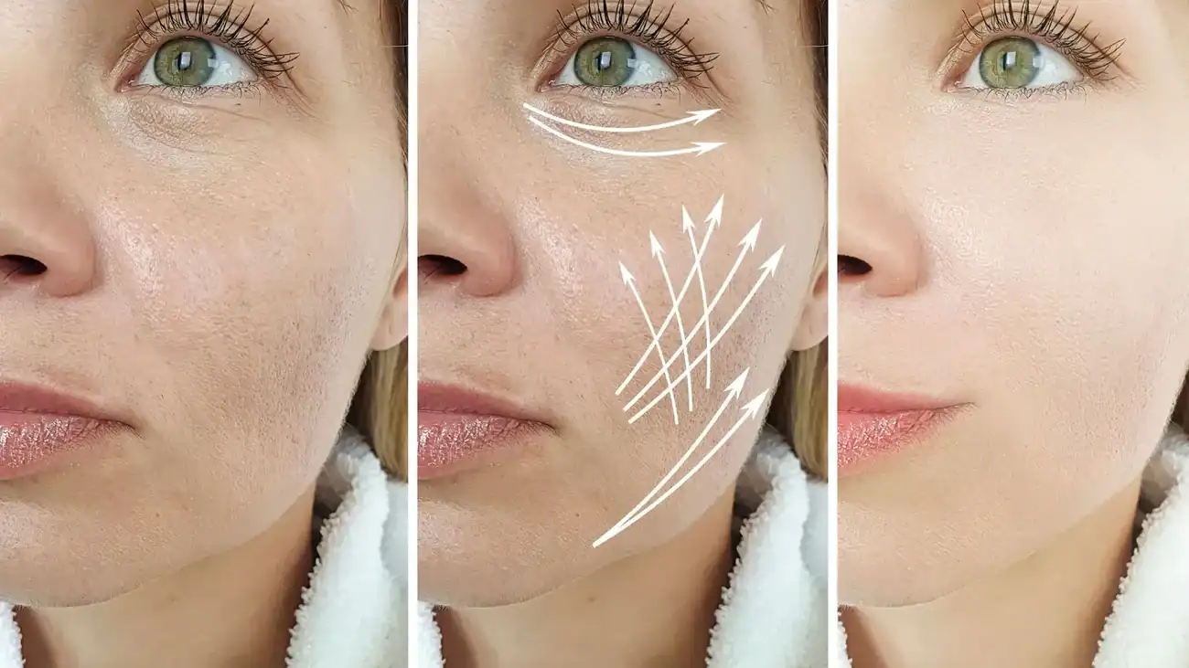 Can One Treatment Really Tackle More Than One Skin Concern Finchampstead?