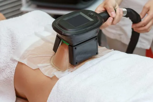 Image of person having fat freezing treatment to help weight gain Finchampstead