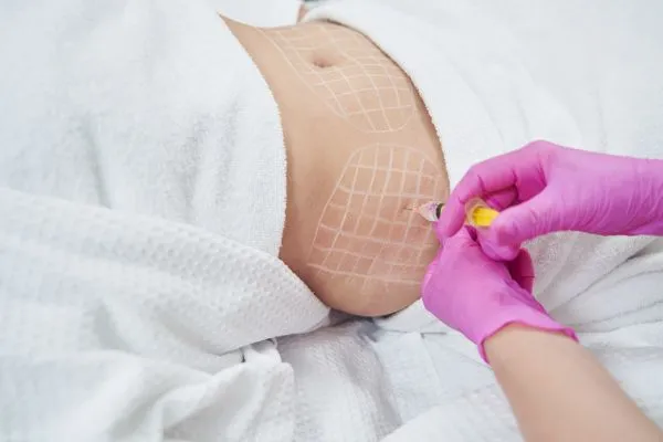image of fat dissolving injections on love handles to help combat weight gain Finchampstead