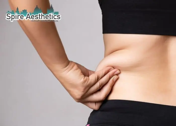 Image of woman pinching fat on their hips Finchampstead. Fat Freezing treatment