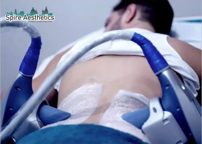 Man having fat freezing treatment done on love handles before a competitions Finchampstead to create a sculpted look.