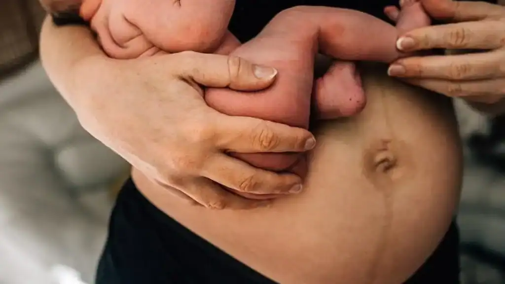 Why Is My Stomach Still Big After Pregnancy Finchampstead?